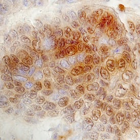 FoxK1 antibody in Human Colon by Immunohistochemistry (IHC-P).