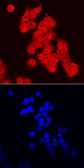 FoxO3 antibody in MCF-7 Human Cell Line by Immunocytochemistry (ICC).