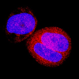 FoxO3 antibody in MCF-7 Human Cell Line by Immunocytochemistry (ICC).