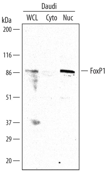 Detection of Human FoxP1 antibody by Western Blot.