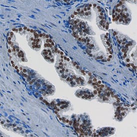 FoxP1 antibody in Human Prostate by Immunohistochemistry (IHC-P).