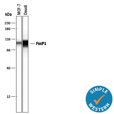 Detection of Human FoxP1 antibody by Simple WesternTM.