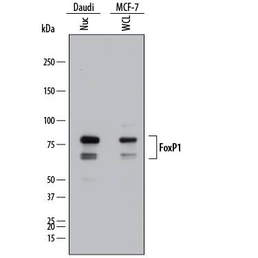 Detection of Human FoxP1 antibody by Western Blot.