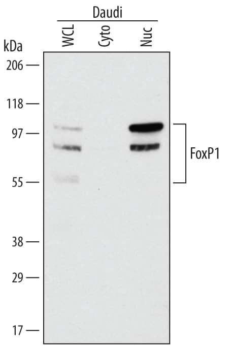 Detection of Human FoxP1 antibody by Western Blot.