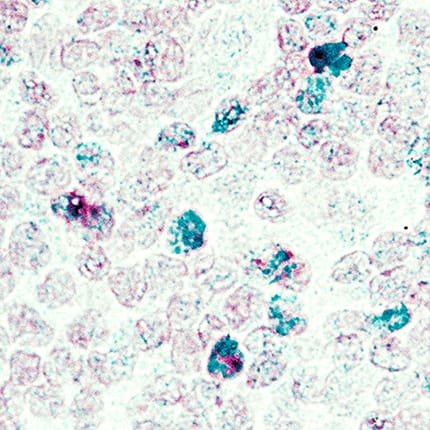 FoxP3 antibody in Human Tonsil Using Dual RNAscope®ISH and IHC.