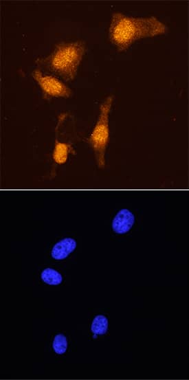 FoxP3 antibody in HeLa Human Cell Line by Immunocytochemistry (ICC).