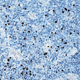 FoxP3 antibody in Human Tonsil by Immunohistochemistry (IHC-P).
