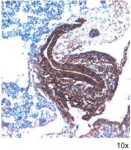 Frizzled‑7 in Embryonic Mouse Gastrointestinal Tract. Frizzled-7 antibody in Embryonic Mouse Gastrointestinal Tract by Immunohistochemistry (IHC-Fr).