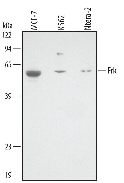 Detection of Human Frk antibody by Western Blot.