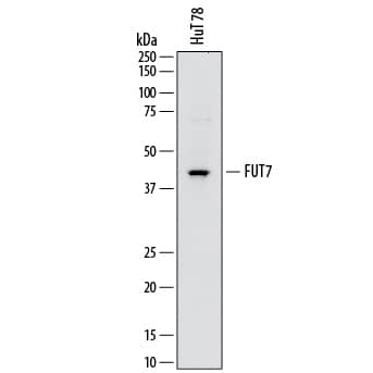 Detection of Human Fucosyltransferase 7/FUT7 antibody by Western Blot.