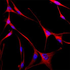 GABARAP antibody in A172 Human Cell Line by Immunocytochemistry (ICC).