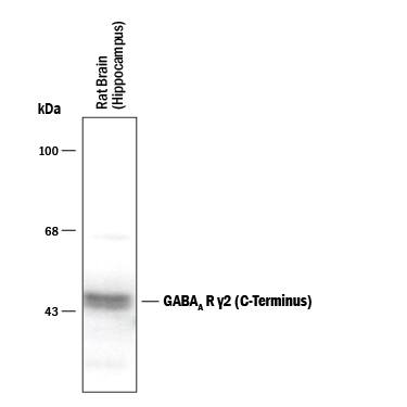 Detection of GABAAR  gamma2 C-Terminus Western Blot.