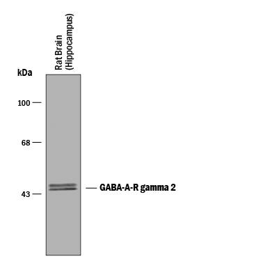 Detection of GABAAR ?2 antibody by Western Blot.