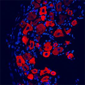 GABABR1 antibody in Rat Trigeminal Ganglia by Immunohistochemistry (IHC-Fr).