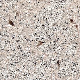 GABABR2 antibody in Human Brain by Immunohistochemistry (IHC-P).