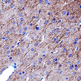 GABABR2 antibody in Rat Brain by Immunohistochemistry (IHC-P).