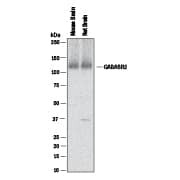 Detection of Mouse and Rat GABABR2 antibody by Western Blot.