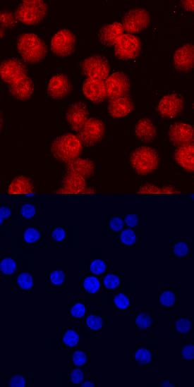 GADD153 antibody in Jurkat Human Cell Line by Immunocytochemistry (ICC).