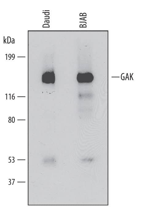 Detection of Human GAK antibody by Western Blot.