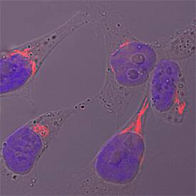 Polypeptide GalNac Transferase 2/GALNT2 antibody in HeLa Human Cell Line by Immunocytochemistry (ICC).