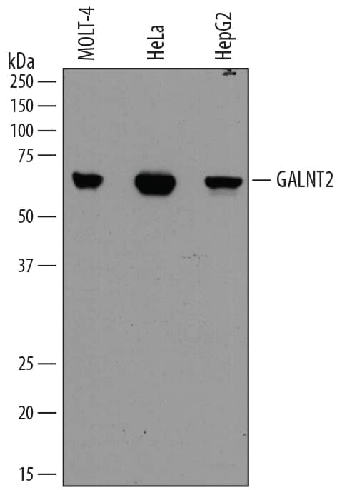 Detection of Human Polypeptide GalNac Transferase 2/GALNT2 antibody by Western Blot.