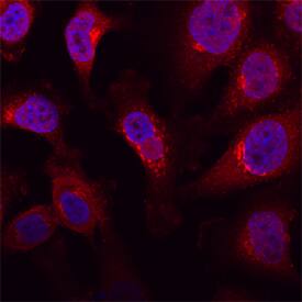 Polypeptide GalNac Transferase 3/GALNT3 antibody in HeLa Human Cell Line by Immunocytochemistry (ICC).