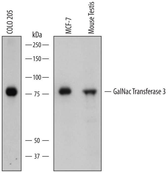 Detection of Human and Mouse Polypeptide GalNac Transferase 3/GALNT3 antibody by Western Blot.