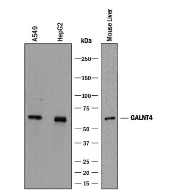 Detection of Human and Mouse Polypeptide GalNac Transferase 4/GALNT4 antibody by Western Blot.