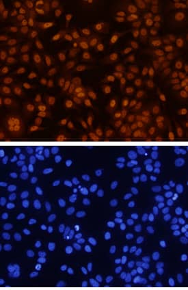 GATA-3 antibody in MCF-7 Human Cell Line by Immunocytochemistry (ICC).