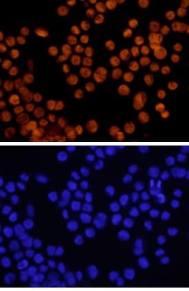 GATA-6 antibody in KATO-III Human Cell Line by Immunocytochemistry (ICC).