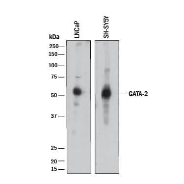 Detection of Human GATA-2 antibody by Western Blot.