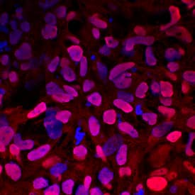 GATA-4 antibody in iBJ6 iPS Cell Line by Immunocytochemistry (ICC).