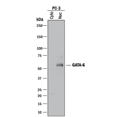 Detection of Human GATA-6 antibody by Western Blot.