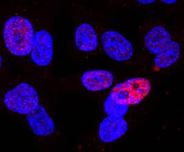 GATA-6 antibody in HCT-116 Human Cell Line by Immunocytochemistry (ICC).