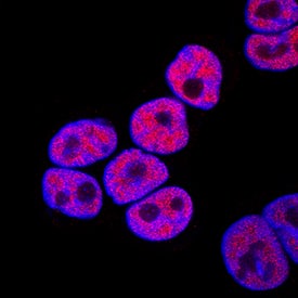 GATA-6 antibody in HT-29 Human Cell Line by Immunocytochemistry (ICC).