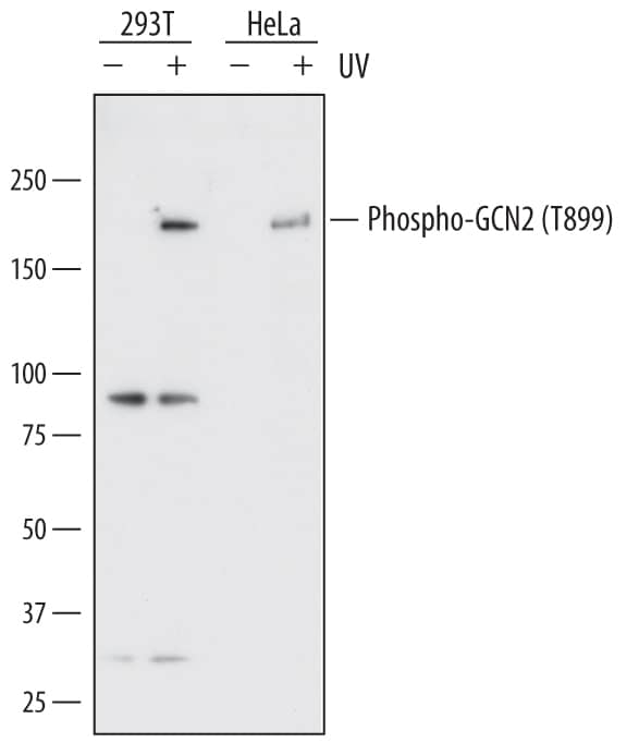 Detection of Human Phospho-GCN2 (T899) antibody by Western Blot.