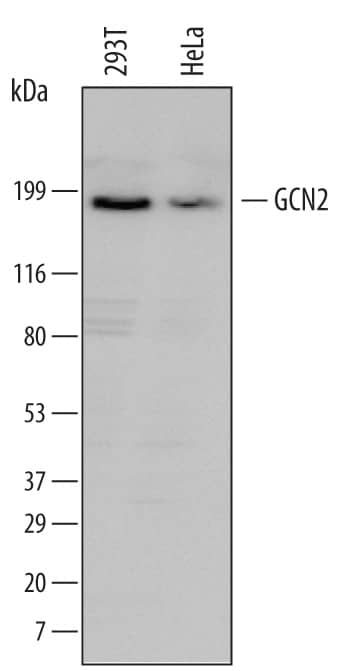 Detection of Human GCN2 antibody by Western Blot.