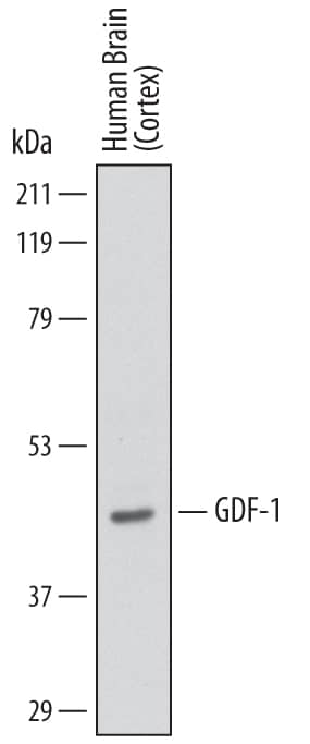 Detection of Human GDF-1 antibody by Western Blot.