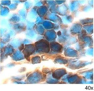 GDF-3 antibody in Mouse Thymus by Immunohistochemistry (IHC-Fr).