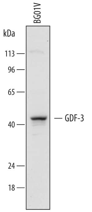 Detection of Human GDF-3 antibody by Western Blot.