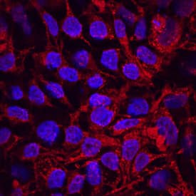 GDF-3 antibody in BG01V Human Embryonic Stem Cells by Immunocytochemistry (ICC).