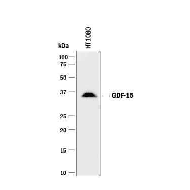 Detection of Human GDF-15 antibody by Western Blot.