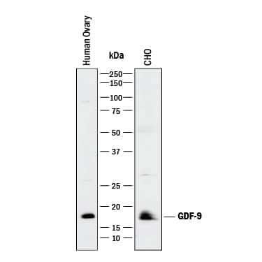 Detection of Mouse and Hamster GDF-9 antibody by Western Blot.