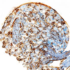 GFRa-2/GDNF Ra-2 antibody in Mouse Dorsal Root Ganglion by Immunohistochemistry (IHC-Fr).