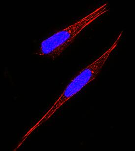 GFRa-2/GDNF Ra-2 antibody in SH-SY5Y Human Cell Line by Immunocytochemistry (ICC).