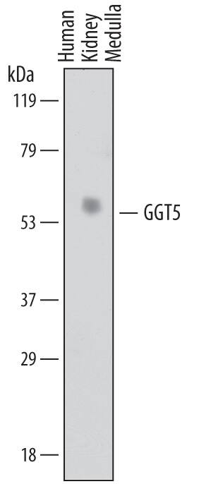 Detection of Human GGT5 antibody by Western Blot.