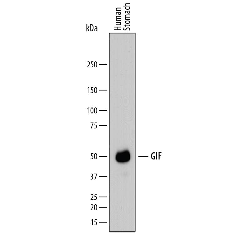 Detection of Human GIF antibody by Western Blot.