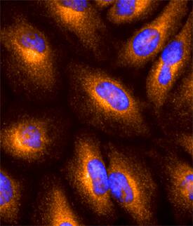 GILT/IFI30 antibody in MCF-7 Human Cell Line by Immunocytochemistry (ICC).