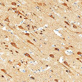 GIT1 antibody in Human Brain by Immunohistochemistry (IHC-P).