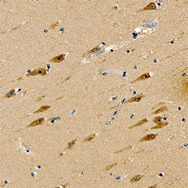 GIT1 antibody in Human Brain by Immunohistochemistry (IHC-P).